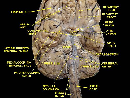 Cerveau. Vue inférieure. Dissection profonde.