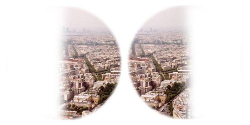 Paris vu avec une hémianopsie bitemporale