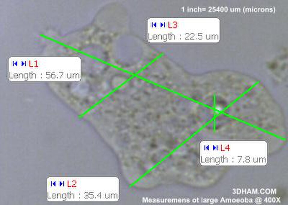 Mesures d'une grande amibe à un grossissement de 400×