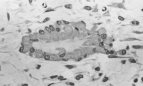 Micrographie optique d'un tissu non décalcifié montrant des ostéoblastes synthétisant activement l'ostéoïde (centre).