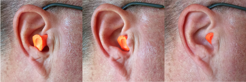 Trois photographies d'une oreille avec des bouchons d'oreille insérés à l'intérieur