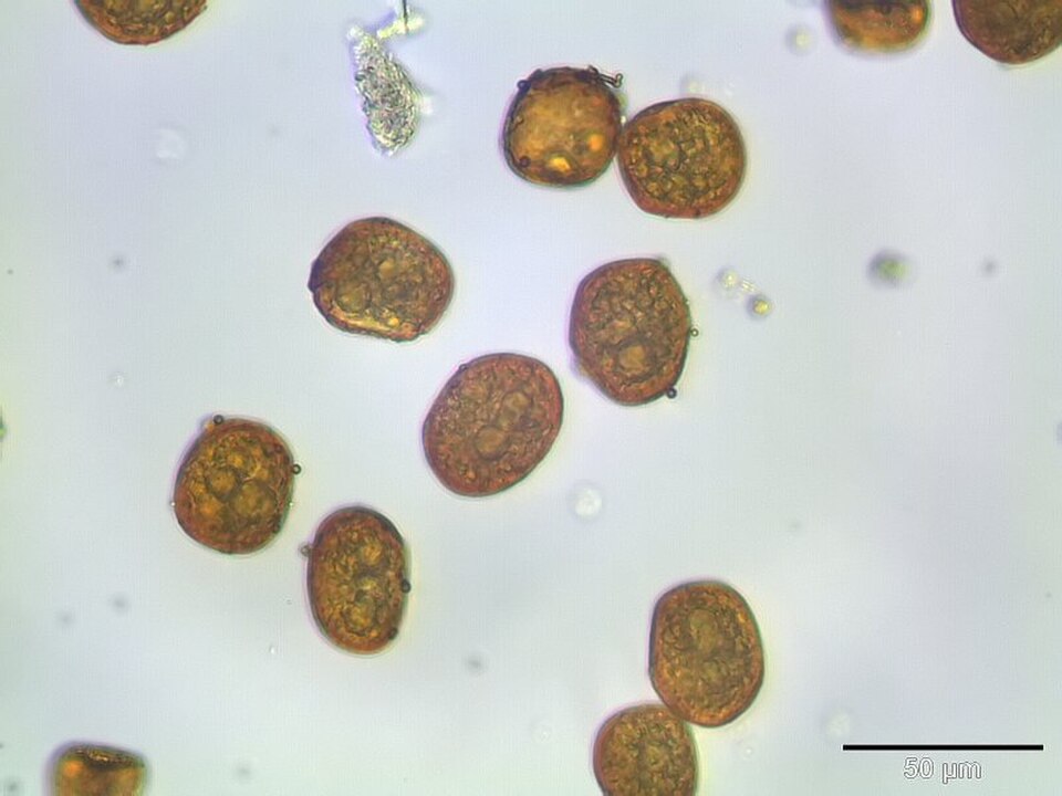 Spores de la mousse Bartramia ithyphylla. (vue microscopique, grossissement 400x)