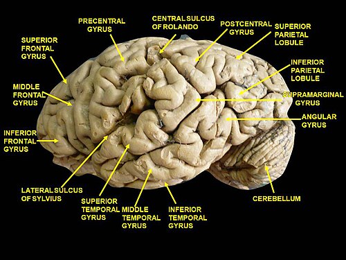 Cerveau. Vue latérale. Dissection profonde. Circonvolution temporale inférieure marquée en bas au centre.