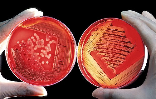 Gélose aux globules rouges. Le sang apparaît rouge en raison des molécules de fer présentes dans les cellules sanguines.