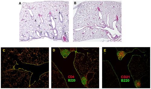 Lames histologiques de BALT induit chez la souris