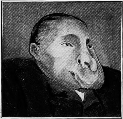 Lèvre supérieure