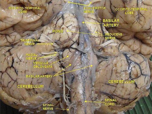 Cerveau. Vue inférieure. Dissection profonde.