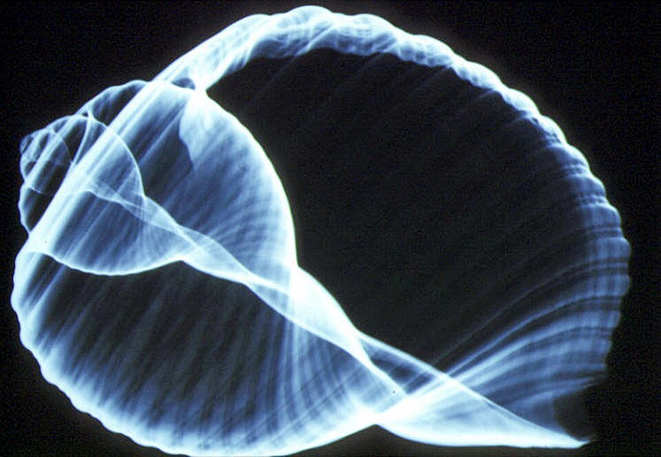 Image radiographique de la coquille de Tonna galea