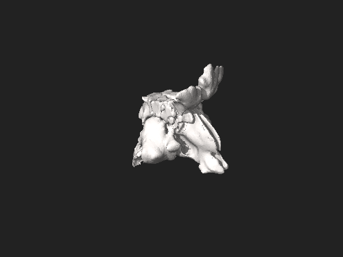 Moulage 3D des sinus maxillaires, frontaux, ethmoïdaux et sphénoïdaux, de la cavité nasale et de l'hypopharynx