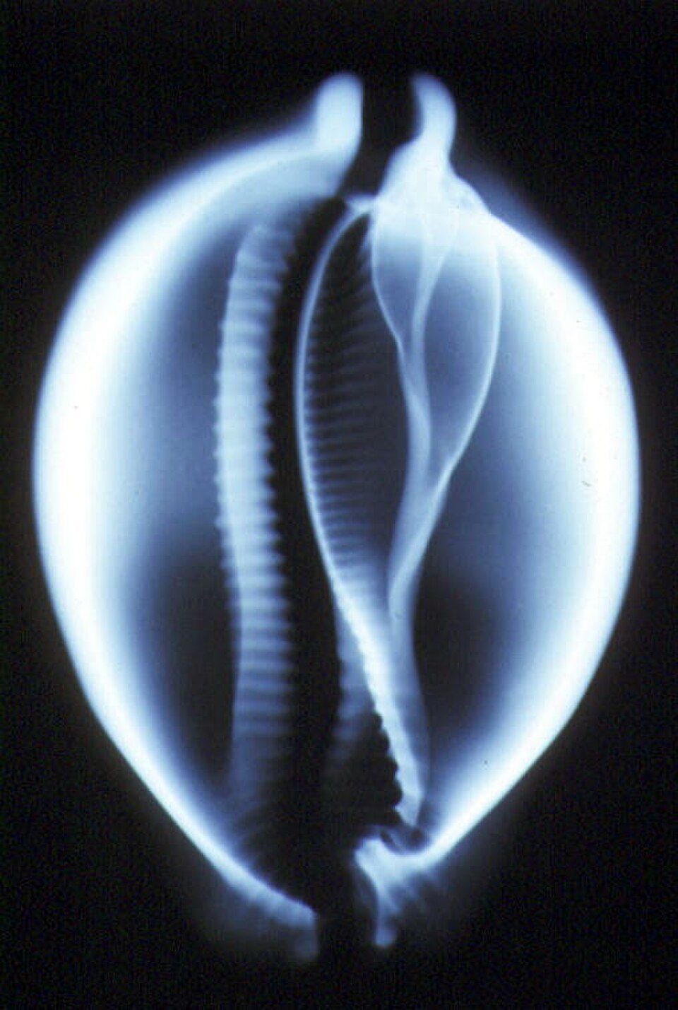 Image radiographique de Cypraea