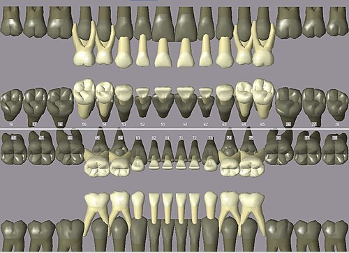 notation ISO des dents primaires