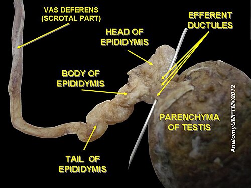 Testicule