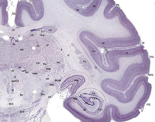 Coupe de tissu cérébral d'un macaque adulte. Le cortex cérébral est représenté en violet foncé.