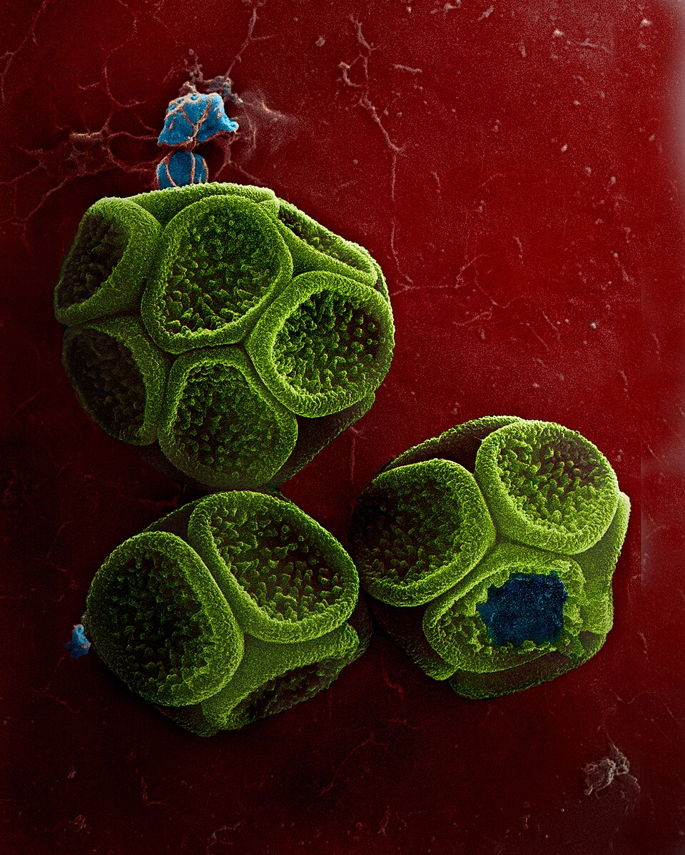 Amas de spores, formés à l'intérieur des sporanges du myxomycète Reticularia olivacea, provenant des forêts de pins de l'est de l'Ukraine
