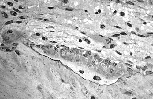 Micrographie optique d'os spongieux décalcifié montrant des ostéoblastes synthétisant activement de l'ostéoïde, contenant deux ostéocytes.