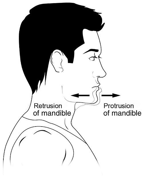Exemples illustrant la protrusion et la rétrusion.