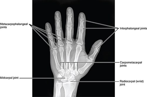 Les articulations de la main sur une image radiographique