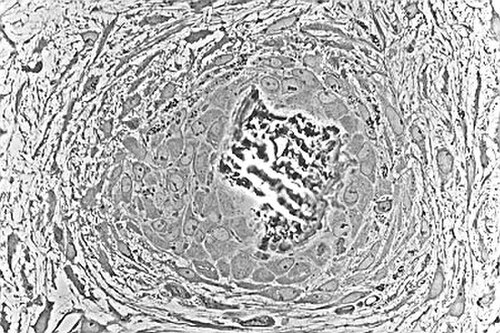 Micrographie optique d'un tissu non décalcifié montrant des ostéoblastes synthétisant activement du tissu osseux rudimentaire (centre).